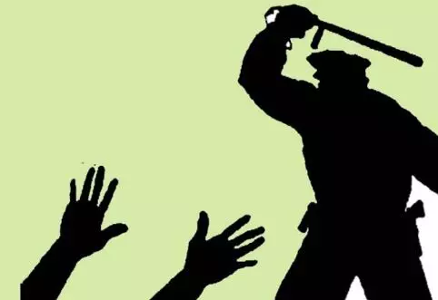 ਪੰਜਾਬ ਦੀਆਂ ਹਿਰਾਸਤੀ ਮੌਤਾਂ ਦੀ ਸੰਸਦ ਚ ਗੂੰਜ, ਪਹਿਲੇ 74 ਦਿਨਾਂ ਦੌਰਾਨ ਪੰਜਾਬ ਪੁਲਿਸ ਦੀ ਹਿਰਾਸਤ ਚ ਹੋਈਆਂ 14 ਮੌਤਾਂ ਪੰਜਾਬ ਦੀਆਂ ਹਿਰਾਸਤੀ ਮੌਤਾਂ ਦੀ ਸੰਸਦ ਚ ਗੂੰਜ, ਪਹਿਲੇ 74 ਦਿਨਾਂ ਦੌਰਾਨ ਪੰਜਾਬ ਪੁਲਿਸ ਦੀ ਹਿਰਾਸਤ ਚ ਹੋਈਆਂ 14 ਮੌਤਾਂ