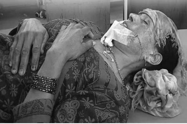 ਔਰਤ ’ਤੇ ਪਿਟਬੁੱਲ ਕੁੱਤਿਆਂ ਵਲੋਂ ਹਮਲਾ, ਗੰਭੀਰ ਜ਼ਖ਼ਮੀ